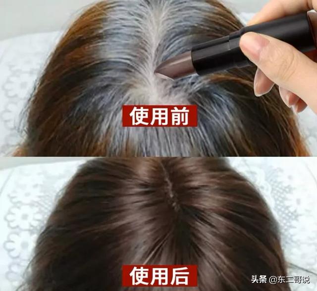 45歲了，頭發(fā)白了很多經(jīng)常染都蓋不住，有什么好辦法嗎？