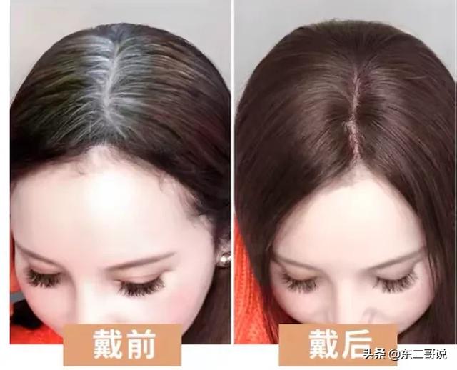 45歲了，頭發(fā)白了很多經(jīng)常染都蓋不住，有什么好辦法嗎？